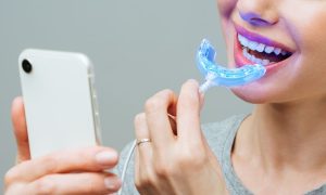 Effectiveness of Different Teeth Whitening Methods — Which One Works The Best?