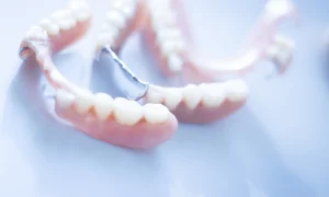 The Perfect Fit: How Partial Dentures Can Restore Your Smile