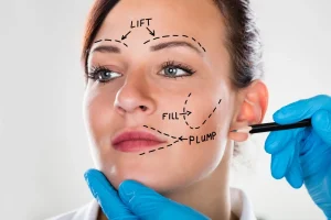 Facelift Basics: Understanding The Procedure