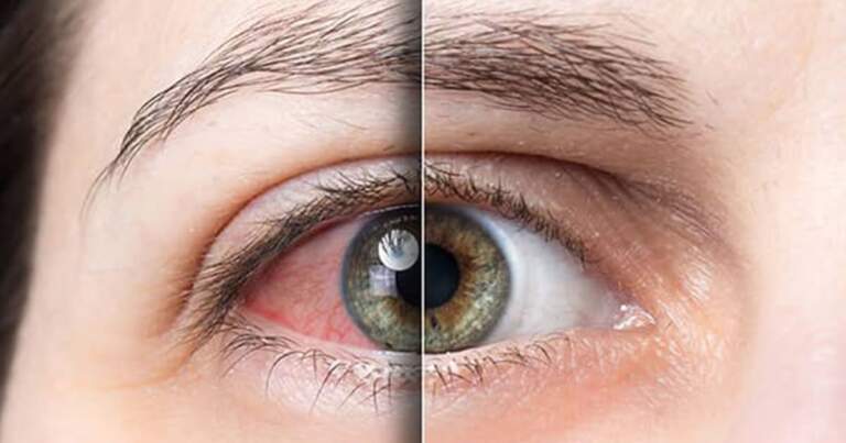 Why Advanced Technology Matters in Eye Care Treatment in Hawaii